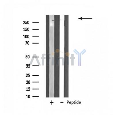 ZNF292 Antibody - Western blot analysis of extracts from HuvEc cells, using ZNF292 antibody.