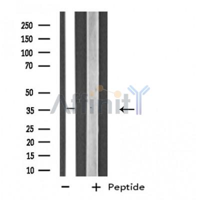 ZNF691 Antibody - Western blot analysis of extracts from HeLa cells, using ZNF691 antibody.