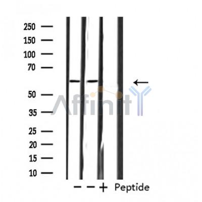 ZNF695 Antibody - Western blot analysis of extracts from Jurkat/293 cells, using ZNF695 antibody.