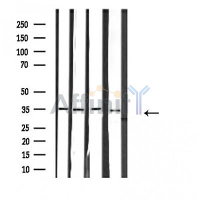 RNF113B Antibody - Western blot analysis of COLO205/K562/JURKAT/293 cell lysates using RNF113B antibody.