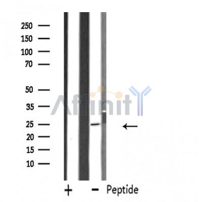 FEV Antibody - Western blot analysis of extracts from K562 cells, using FEV antibody.