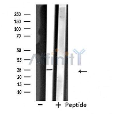 NDFIP1 Antibody - Western blot analysis of extracts from 293 cells, using NDFIP1 antibody.