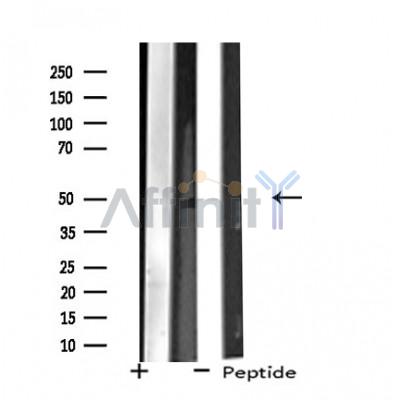 ZNF446 Antibody - Western blot analysis of extracts from HuvEc cells, using ZNF446 antibody.