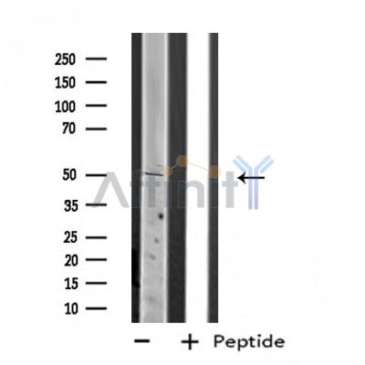 PLAGL1 Antibody - Western blot analysis of extracts from 293 cells, using PLAGL1 antibody.
