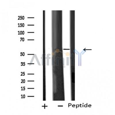 Cytochrome P450 11B1/2 Antibody - Western blot analysis of extracts from COLO205 cells, using Cytochrome P450 11B1/2 antibody.
