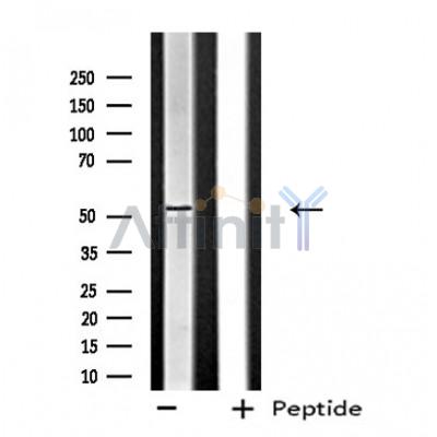 FGRL1 Antibody - Western blot analysis of extracts from NIH-3T3 cells, using FGFRL1 antibody.