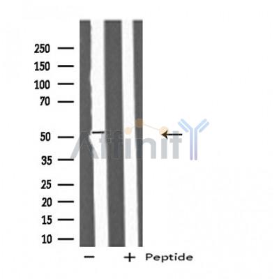 IFIT5 Antibody - Western blot analysis of extracts from Jurkat cells, using IFIT5 antibody.