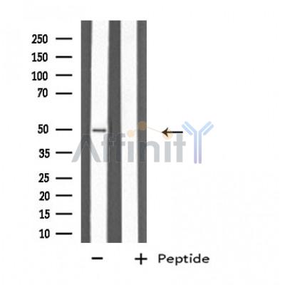KRT37/38 Antibody - Western blot analysis of extracts from LOVO cells, using KRT37/38 antibody.