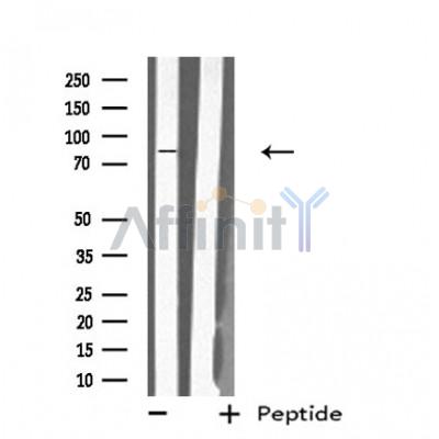 MX2 Antibody - Western blot analysis of extracts from 293 cells, using MX2 antibody.