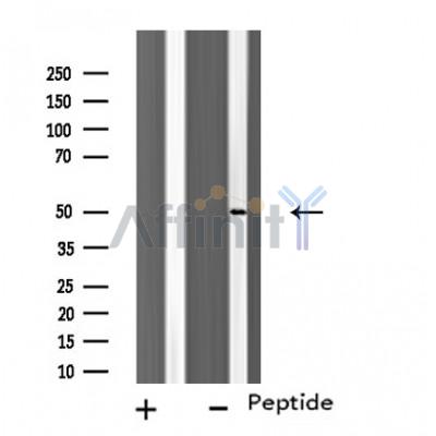 TUBA3C/E Antibody - Western blot analysis of extracts from HuvEc cells using TUBA3C/E antibody.