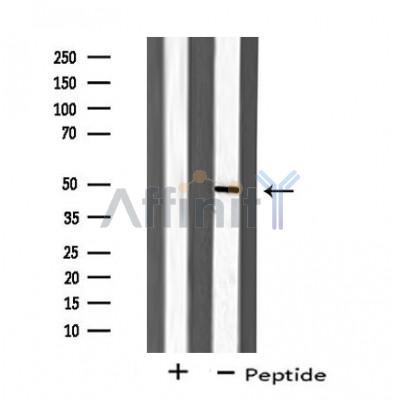 ZAR1 Antibody - Western blot analysis of extracts from 293 cells, using ZAR1 antibody.
