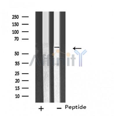 Cytochrome P450 26C1 Antibody - Western blot analysis of extracts from Hela cells, using CP26C antibody.