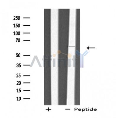 TBXAS1 Antibody - Western blot analysis of extracts from Jurkat cells, using THAS antibody.