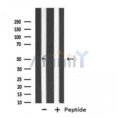 Cytochrome P450 3A7 Antibody - Western blot analysis of extracts from LOVO cells, using Cytochrome P450 3A7 antibody.