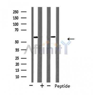 Cytochrome P450 21A2 Antibody - Western blot analysis of extracts from Jurkat/HeLa cells, using CYP21A2 antibody.