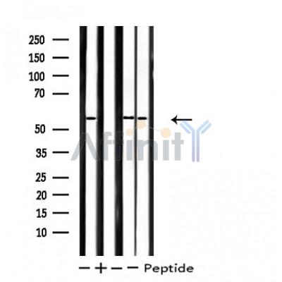 Cytochrome P450 2D6 Antibody - Western blot analysis of extracts from 293/Jurkat/K562 cells, using CYP2D6 antibody.