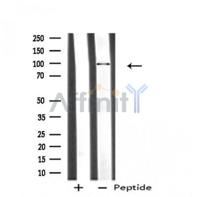 MASTL Antibody - Western blot analysis of extracts from HeLa cells, using MASTL antibody.