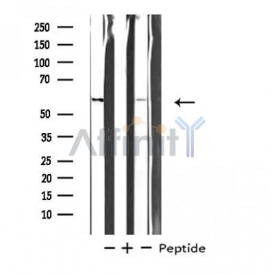 STK33 Antibody - Western blot analysis of extracts from HeLa/293 cells, using STK33 antibody.