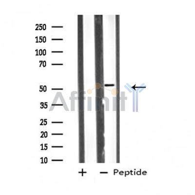 VRK3 Antibody - Western blot analysis of extracts from COLO205 cells, using VRK3 antibody.