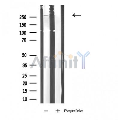 LY75 Antibody - Western blot analysis of extracts from COLO205 cells, using LY75 antibody.