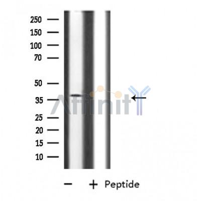 CD300LG Antibody - Western blot analysis of CD300LG using L929 whole cell lysates.