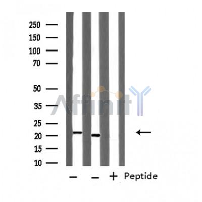Ferritin Heavy Chain Antibody - Western blot analysis of extracts from various samples, using FTH1 Antibody.