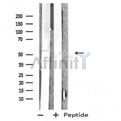 INA Antibody - Western blot analysis of extracts from K562 cells, using INA antibody.