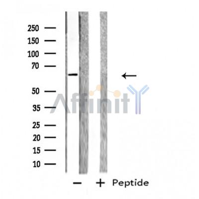 GPC5 Antibody - Western blot analysis of extracts from 293 cells, using GPC5 antibody.
