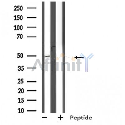GPR152 Antibody - Western blot analysis of extracts from Jurkat cells, using GPR152 antibody.