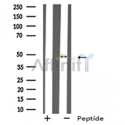GHRHR Antibody - Western blot analysis of extracts from LOVO cells, using GHRHR antibody.