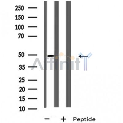 GPR142 Antibody - Western blot analysis of extracts from Jurkat cells, using GPR142 antibody.