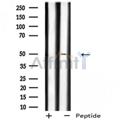 GPR180 Antibody - Western blot analysis of GPR180 expression in Mouse lung lysates .
