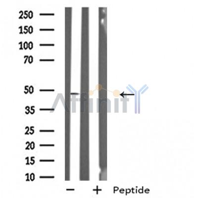 GPR19 Antibody - Western blot analysis of extracts from HeLa cells, using GPR19 antibody.