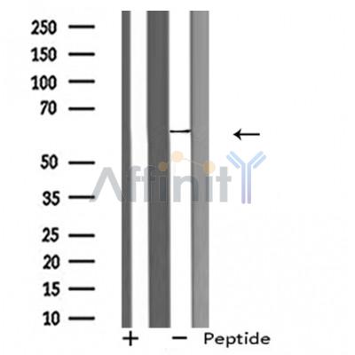 GPROPDR Antibody - Western blot analysis of extracts from HeLa cells, using GPROPDR antibody.