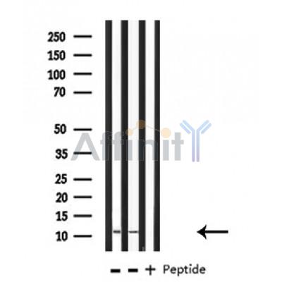 S100A10 Antibody - Western blot analysis of extracts from various samples, using S100 A10 Antibody.