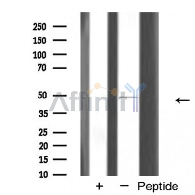GATA6 Antibody - Western blot analysis of GATA6 expression in HeLa cells.