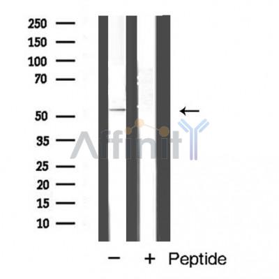 Cyclin A1 Antibody - Western blot analysis of Cyclin A1  expression in SKOV3 cell extract.