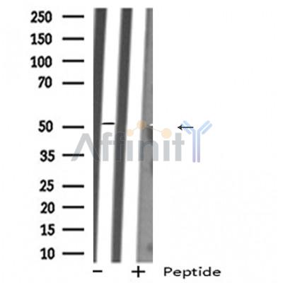 MAOA Antibody - Western blot analysis of extracts from Mouse lung lysates, using MAOA antibody.