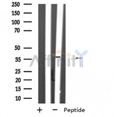 SPARC Antibody - Western blot analysis of extracts from Y79 cell lysates, using SPARC antibody.