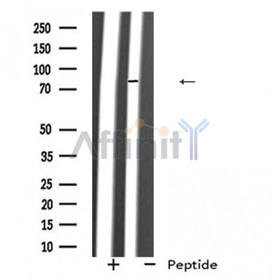 EGF Antibody - Western blot analysis of EGF expression in Mouse liver lysates,The lane on the left was treated with the antigen-specific peptide.