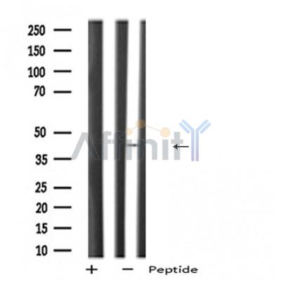 PDHA2 Antibody - Western blot analysis of PDHA2 expression in NCI-H460 cell lysates.