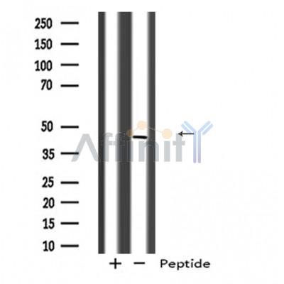 CYLC2 Antibody - Western blot analysis of CYLC2 expression in A431 whole cell lysates ,The lane on the left was treated with the antigen-specific peptide.