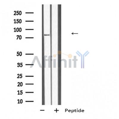 TB10B Antibody - Western blot analysis of TB10B expression in HEK293 cells ,The lane on the left was treated with the antigen-specific peptide.