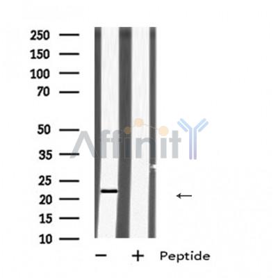 Virion infectivity factor Antibody - Western blot analysis of  expression in HEK293 cells ,The lane on the left was treated with the antigen-specific peptide.