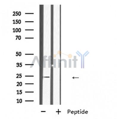INSL6 Antibody - Western blot analysis of INSL6 expression in Human fetal kidney lysates,The lane on the left was treated with the antigen-specific peptide.