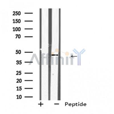 KLF12 Antibody - Western blot analysis of KLF12 expression in 293T whole cell lysates ,The lane on the left was treated with the antigen-specific peptide.