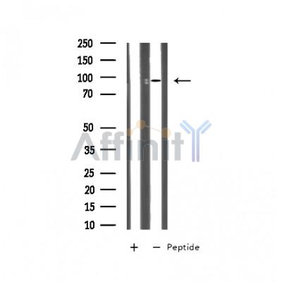 MTA1 Antibody - Western blot analysis on Jurkat cell lysates using MTA1 Antibody.