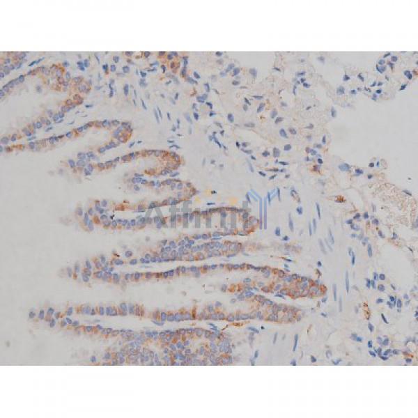 Phospho-Hsp90 beta (Ser254)[Ser255] Antibody - AF3126 at 1/200 staining Rat lung tissue sections by IHC-P.