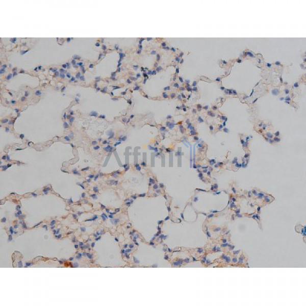 Phospho-Tau (Ser422)[Ser739] Antibody - AF3145 at 1/200 staining Rat lung tissue sections by IHC-P.