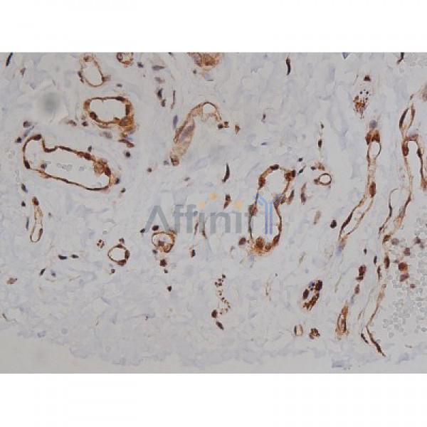 Phospho-Tau (Ser396) Antibody - AF3148 at 1/200 staining Human esophagus tissue sections by IHC-P.